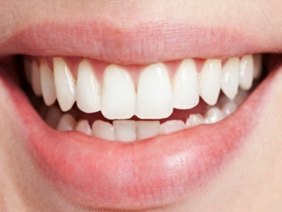 Gencives, dents et chimiothérapie.